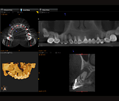 cone beam xray