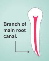 branch of a root canal