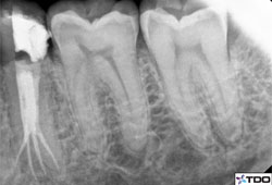 clinical cases