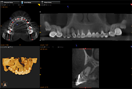 3d dental diagnostics