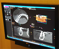 cone beam imaging